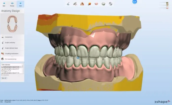 digital denture 